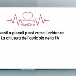 avanti