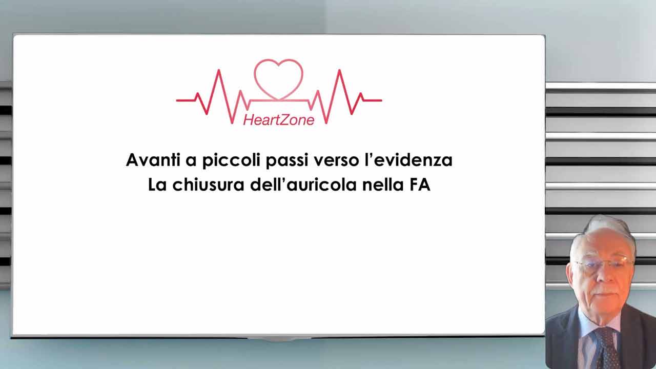 avanti