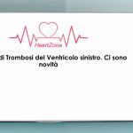 TVS_S