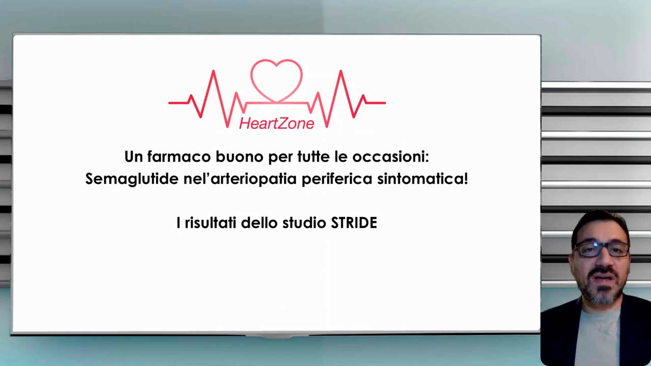 stride_S